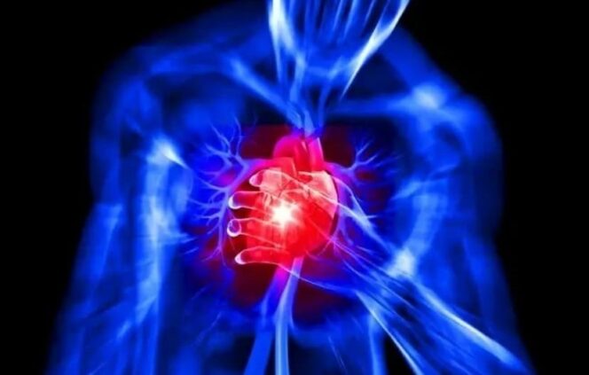 
					6 Penyebab Jantung Bengkak, Begini Cara Mengatasinya  