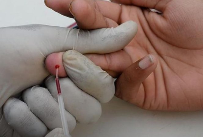 
					Kasus HIV/AIDS di Kota Bekasi Melonjak