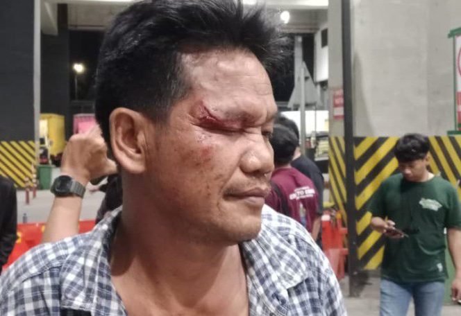 
					Masyarakat Kota Bekasi Soroti soal Kasus Pengeroyokan Kurir Shopee Xpress